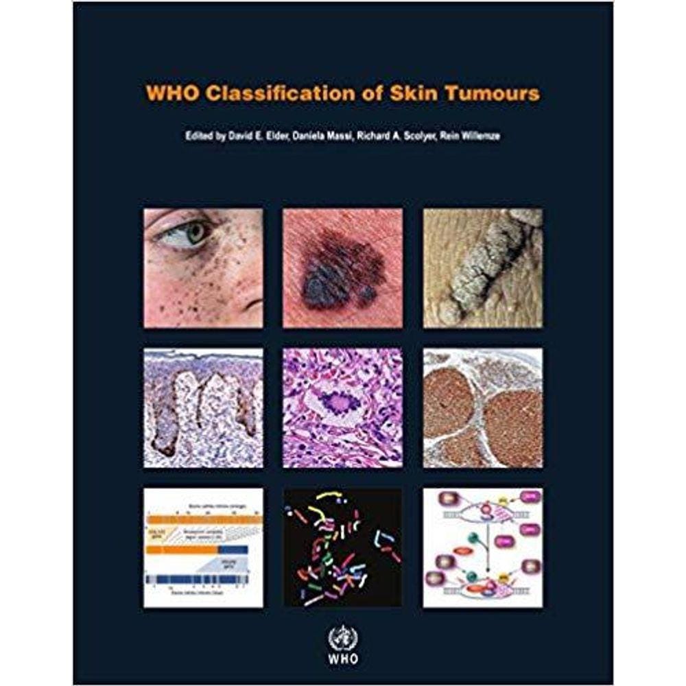 Who Classification Of Skin Tumours