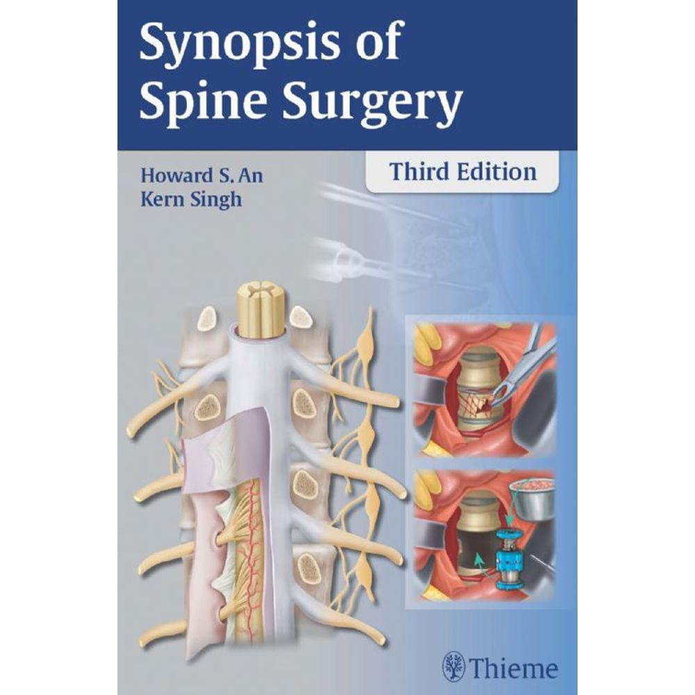 Synopsis Of Spine Surgery