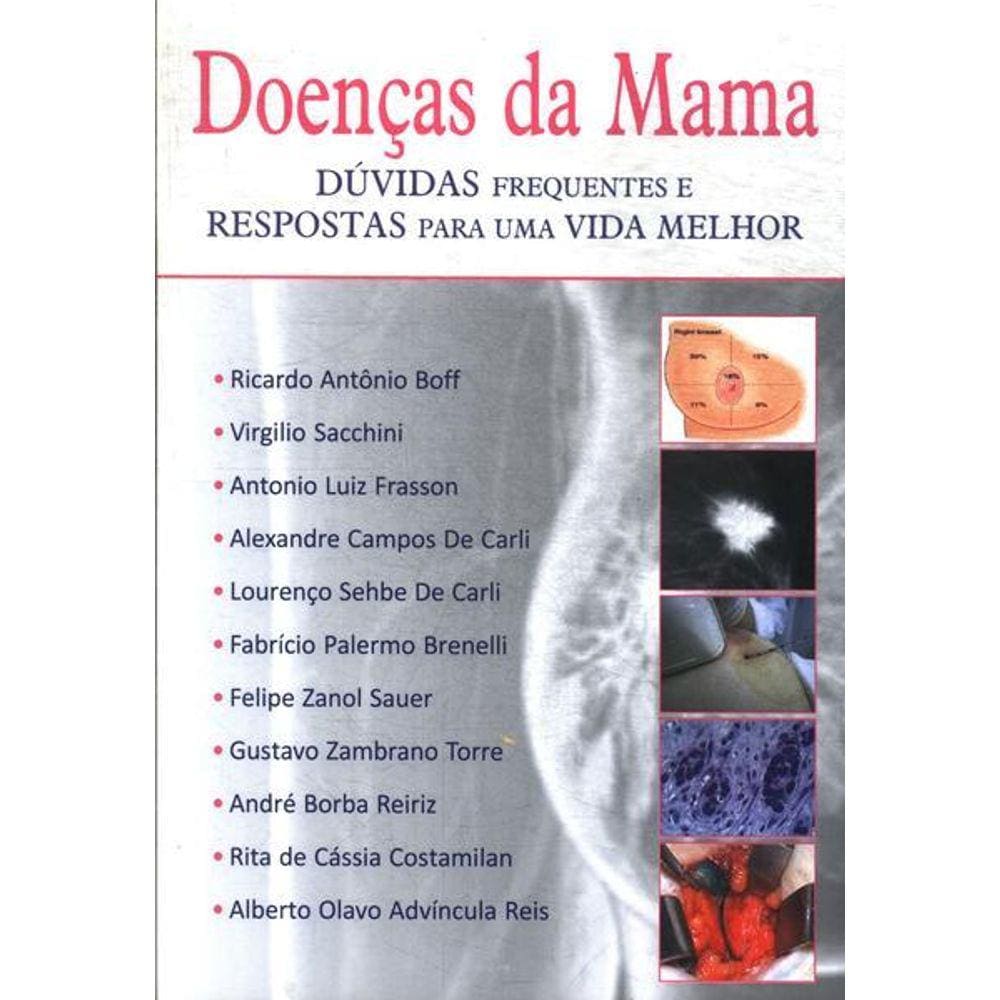 Doencas Da Mama Duvidas E Respostas Para Vida Melhor