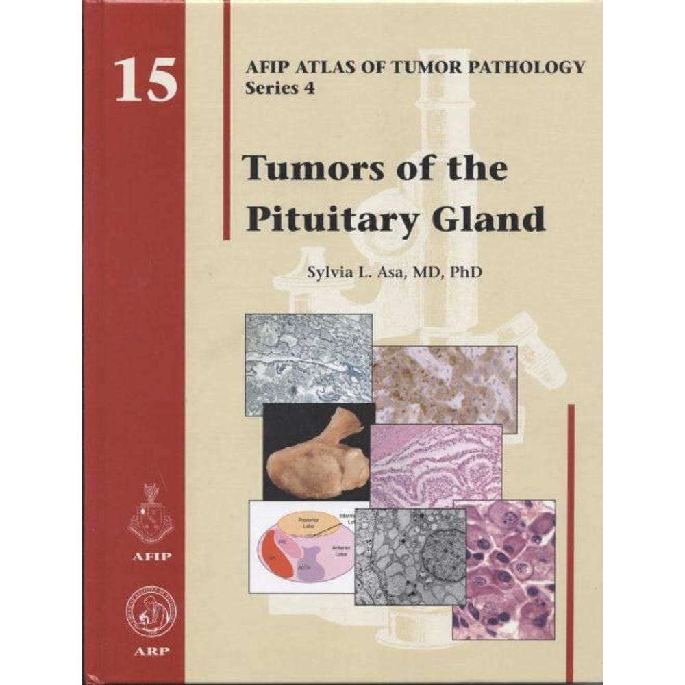 Tumors Of The Pituitary Gland (Afip Atlas Of Tumor Pathology)