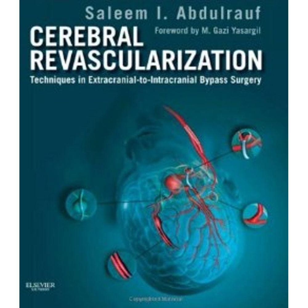Cerebral Revascularization