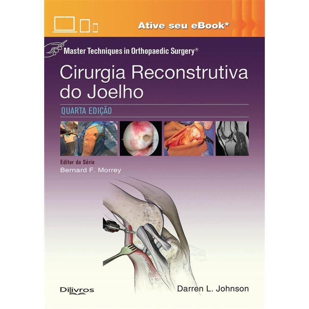 Cirurgia Reconstrutiva Do Joelho Master Techniques In Orthopaedic Surgery