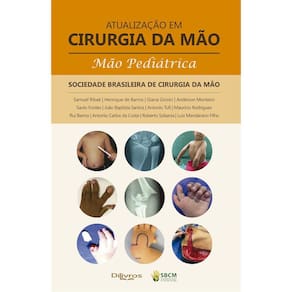 Atualizacao Em Cirurgia Da Mao Mao Pediatrica