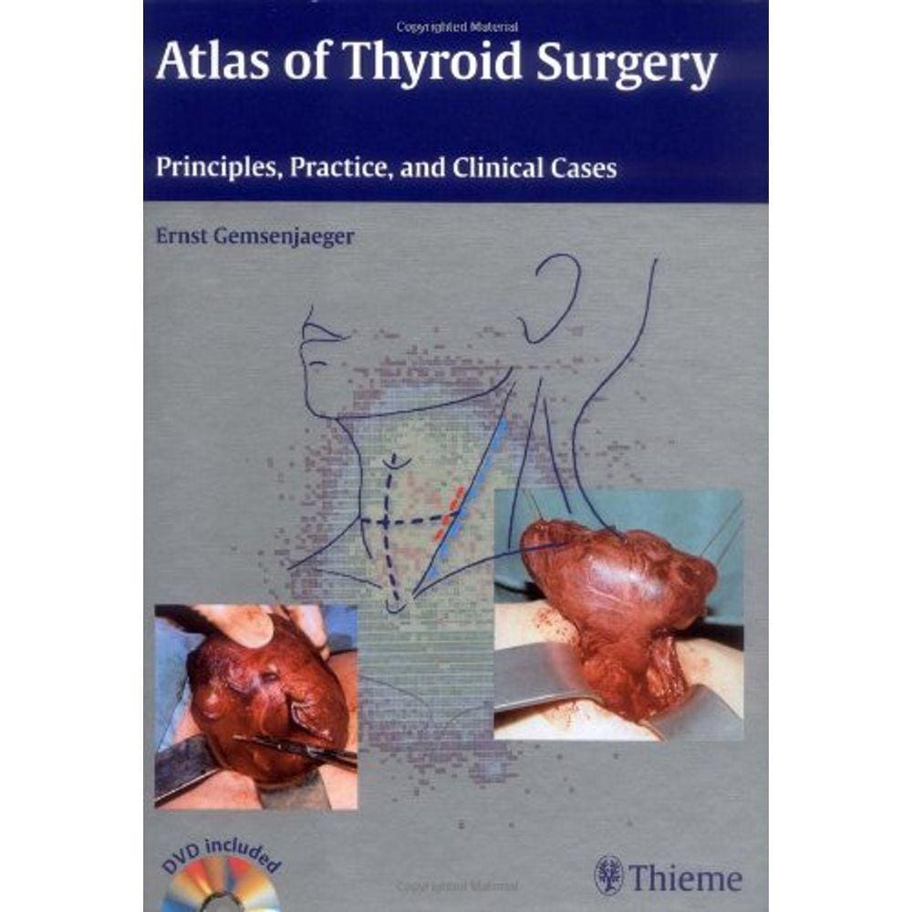 Atlas Of Thyroid Surgery
