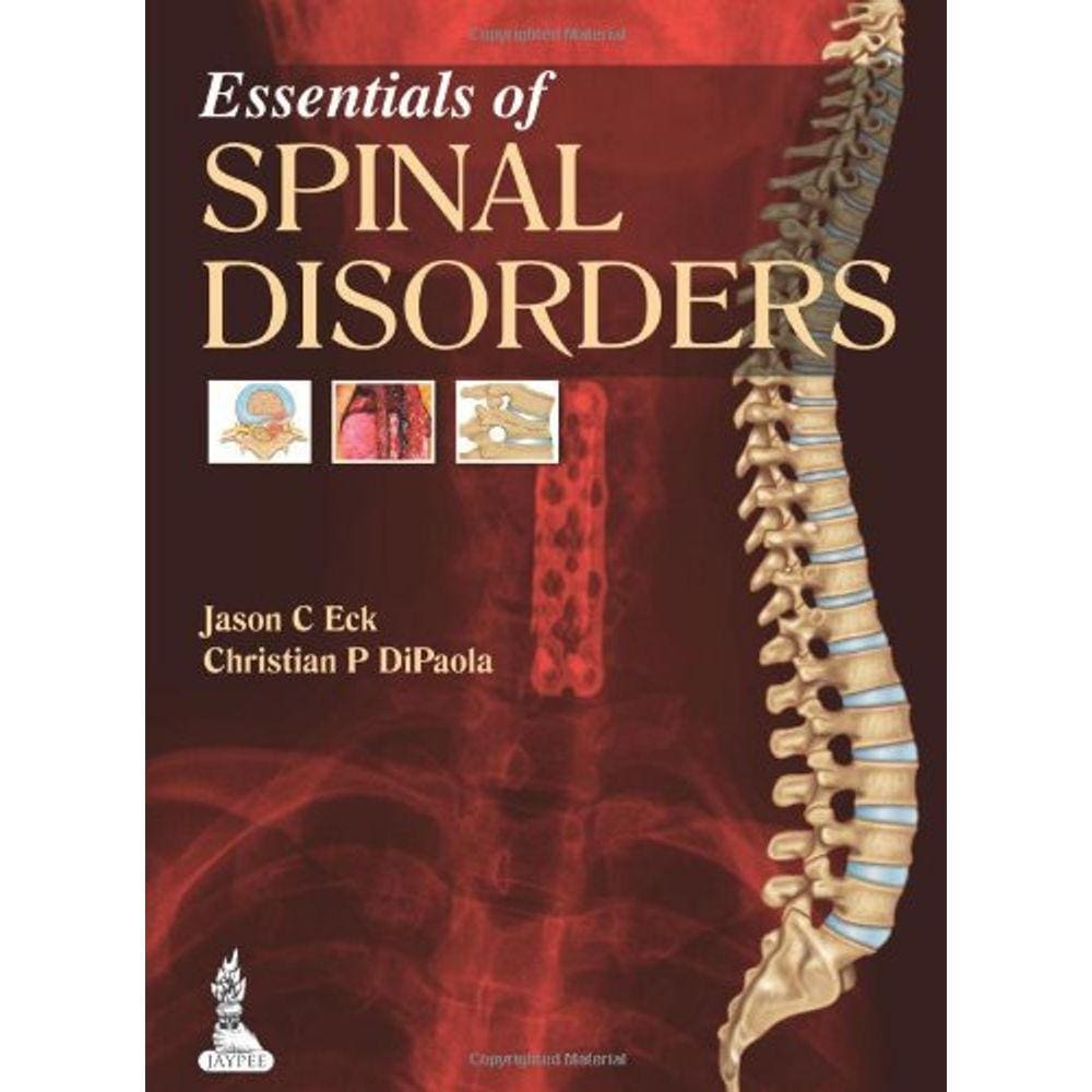 Essentials Of Spinal Disorders