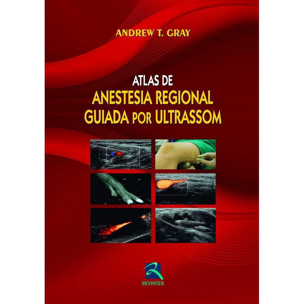 Atlas De Anestesia Regional Guiada Por Ultrason