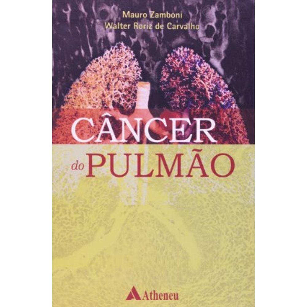 Cancer Do Pulmao