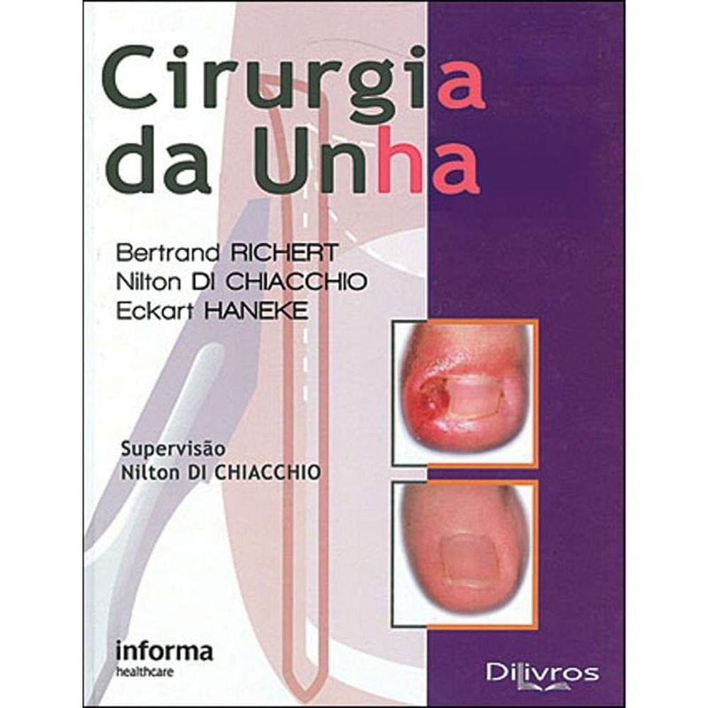 Cirurgia Da Unha