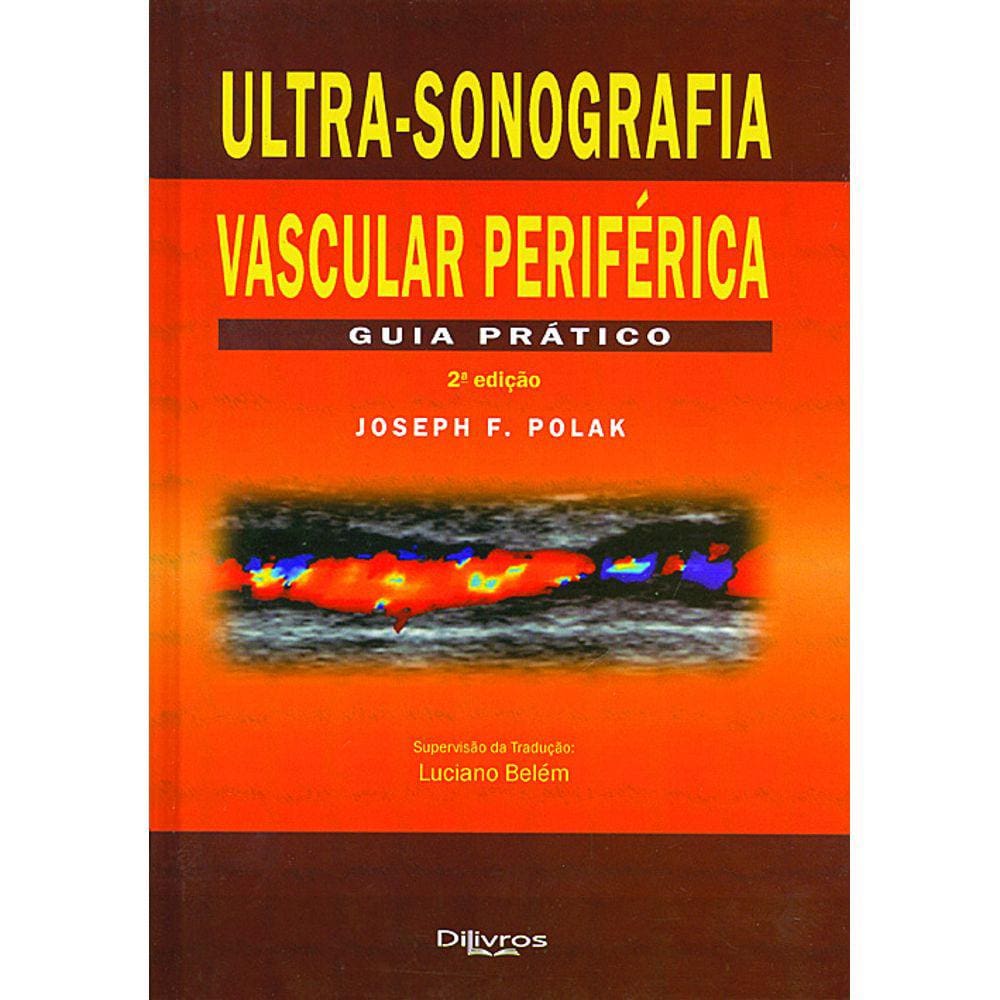Ultra Sonografia Vascular Periferica Guia Pratico