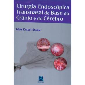 Cirurgia Endoscópica Transnasal Da Base Do Crânio E Do Cérebro