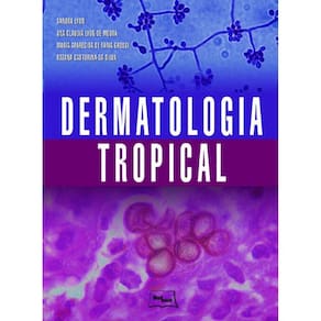 Dermatologia Tropical