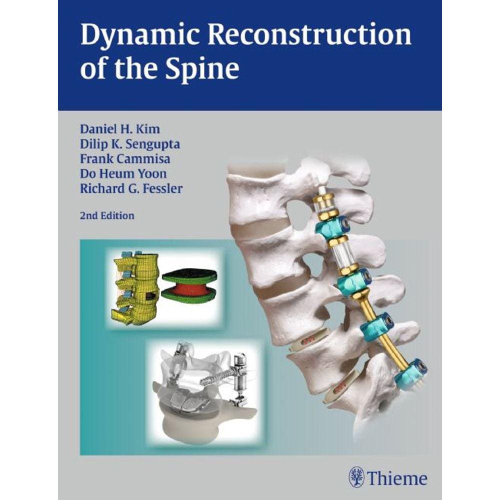 Dynamic Reconstruction Of The Spine