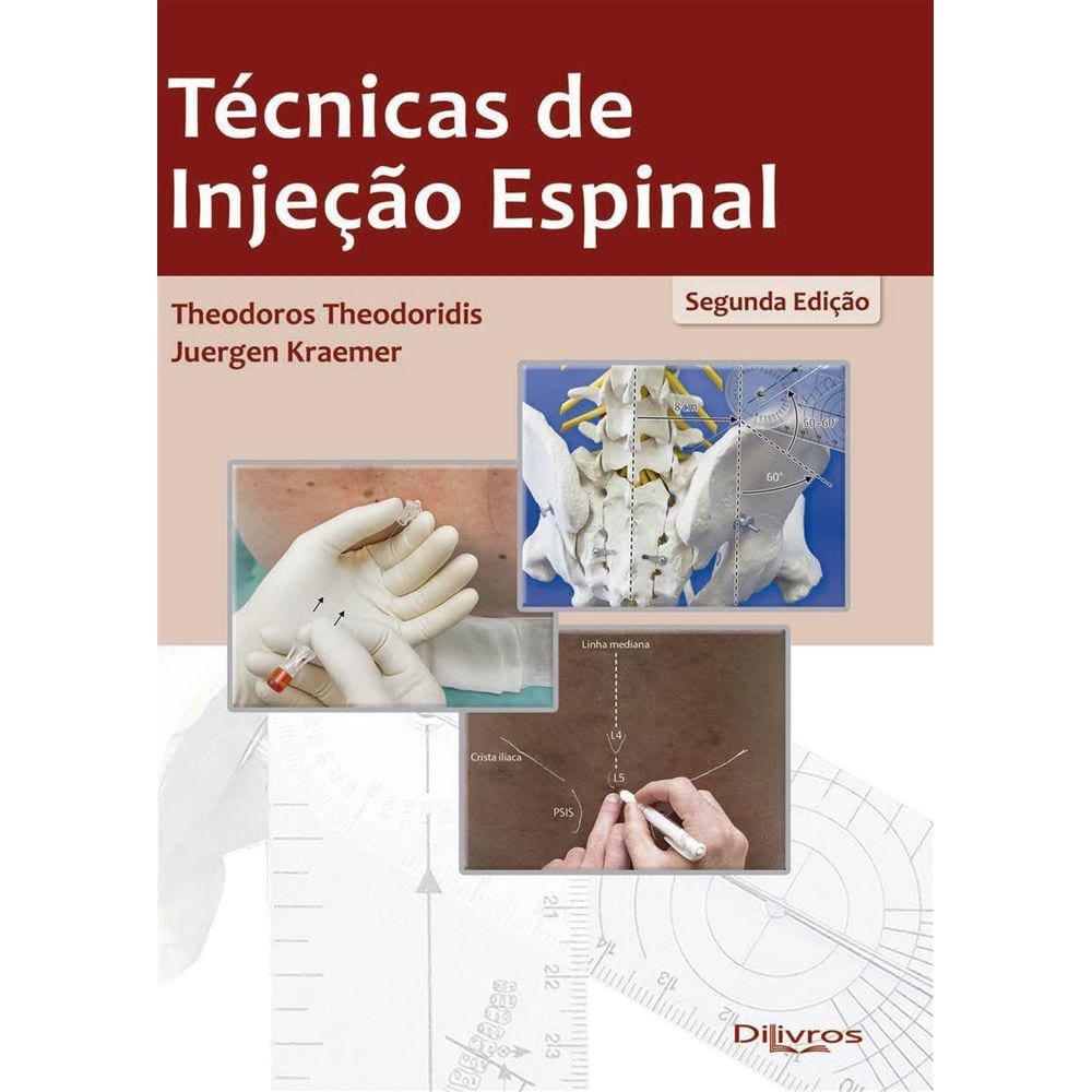Tecnicas De Injecao Espinal