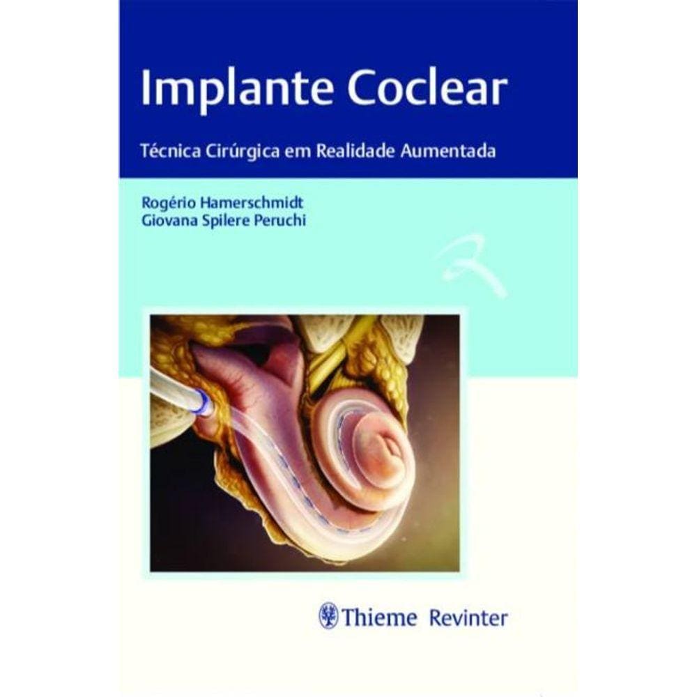 Implante Coclear