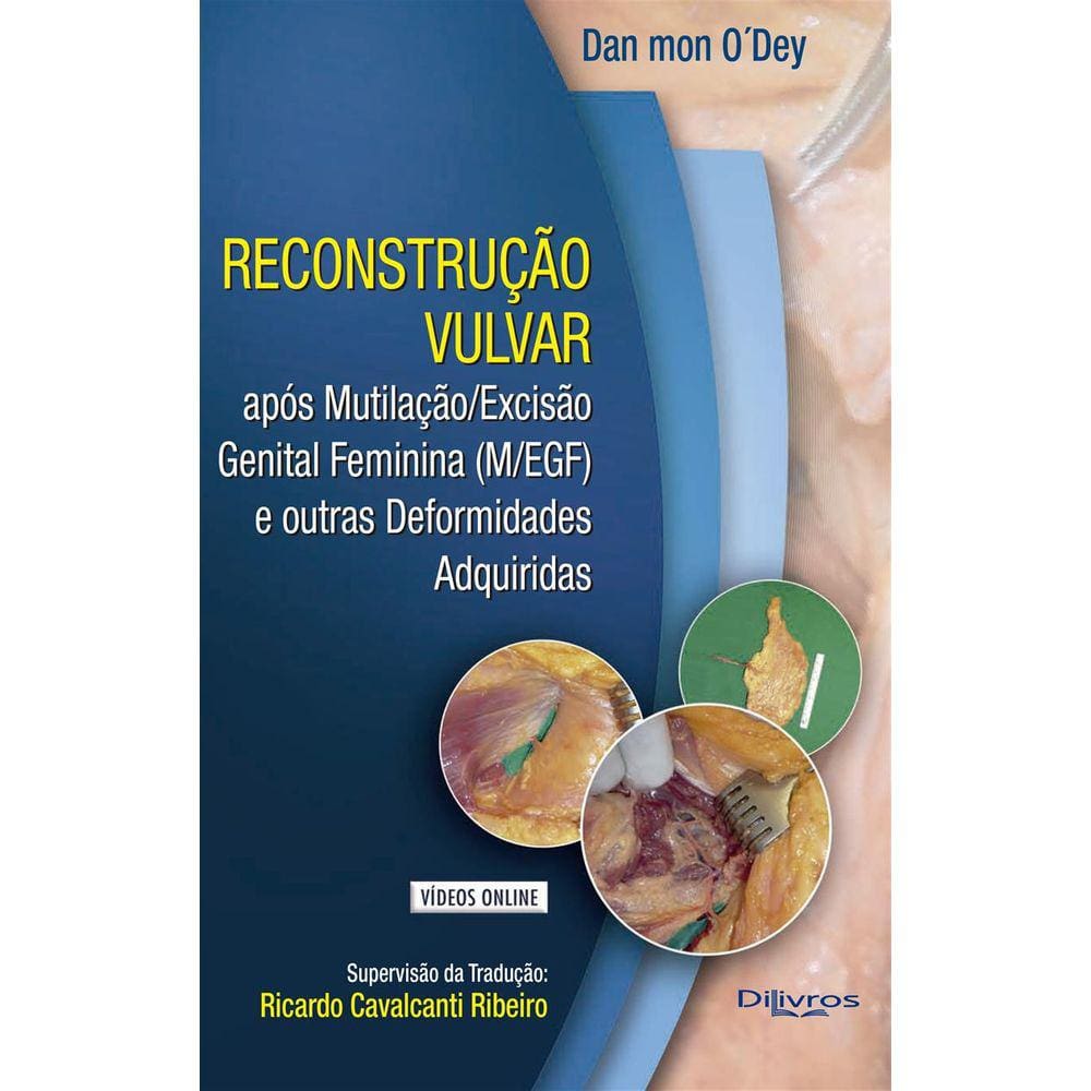 Reconstrucao Vulvar  Com Video
