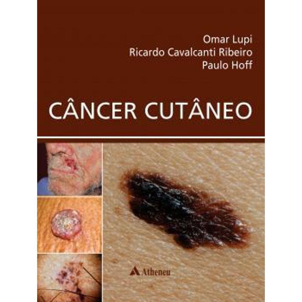 Cancer Cutaneo