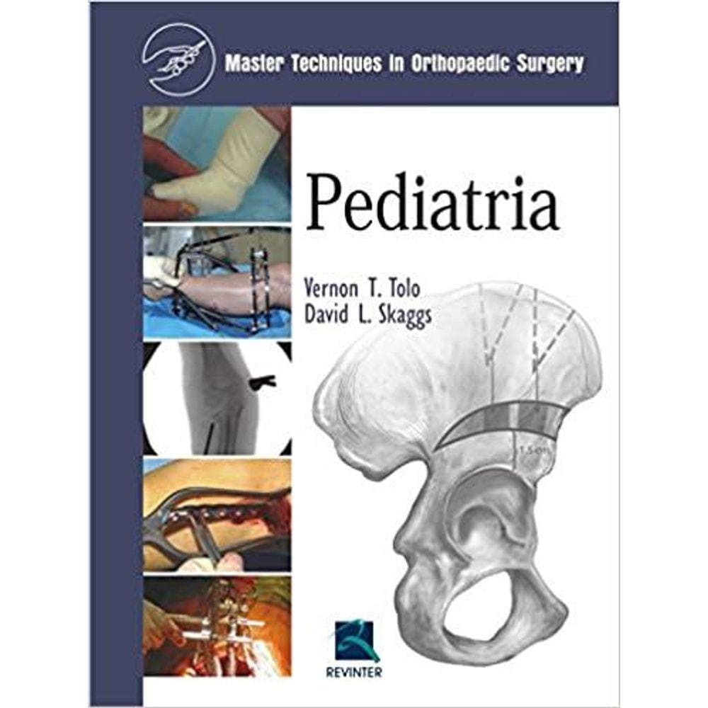 Pediatria - Master Techniq In Orthopaedic Surgery