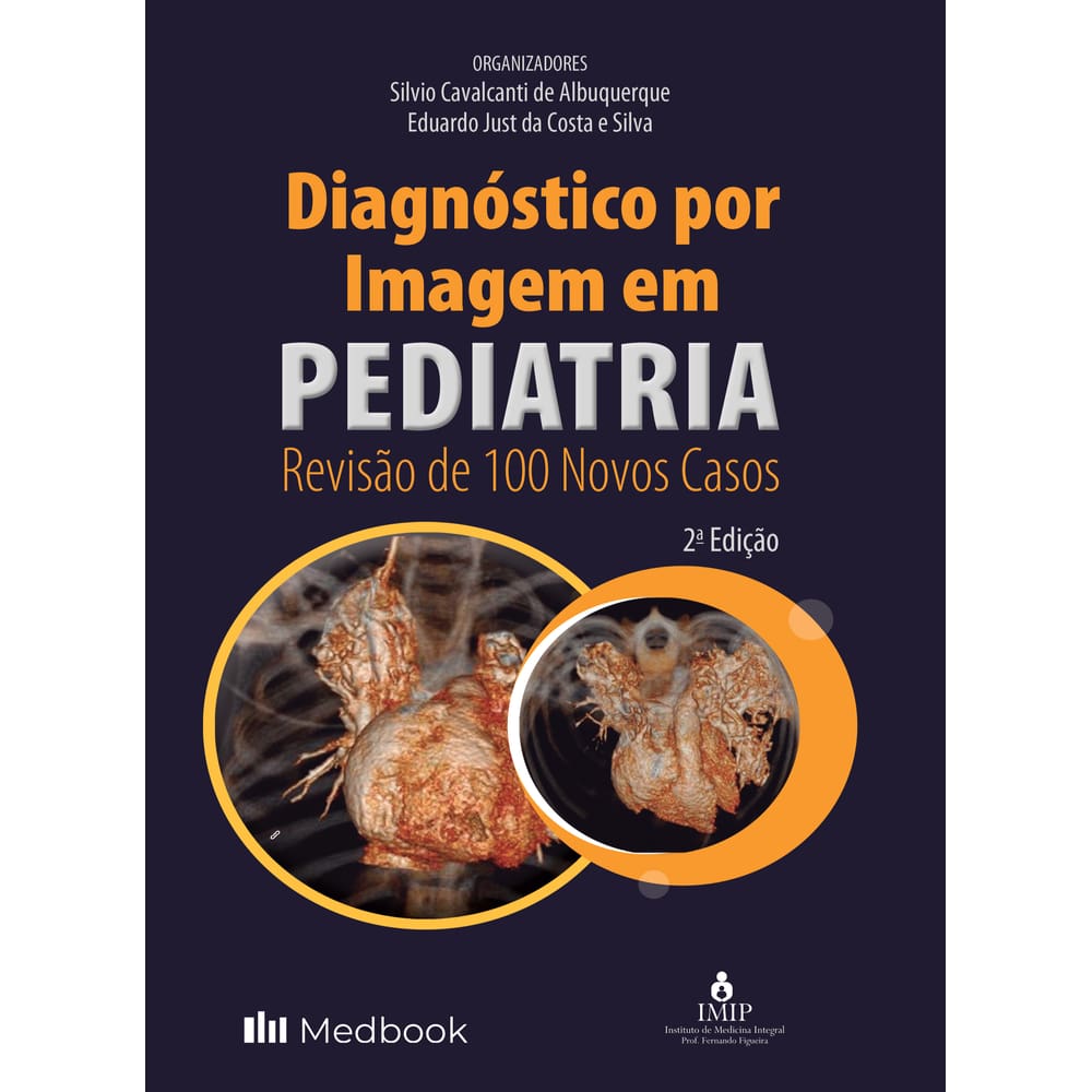 Diagnostico Por Imagem Em Pediatria Revisao De 100 Novos Casos
