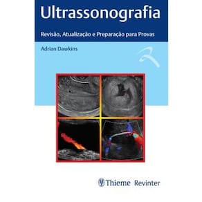 Ultrassonografia