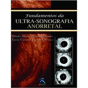 Fundamentos Da Ultra Sonografia Anorretal