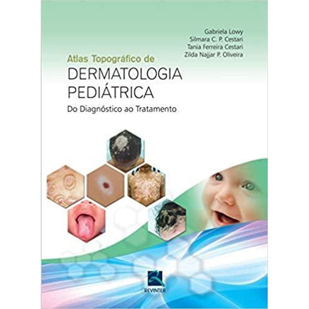 Atlas Topografico De Dermatologia Pediatrica - Do Diagnostico Ao Tratamento