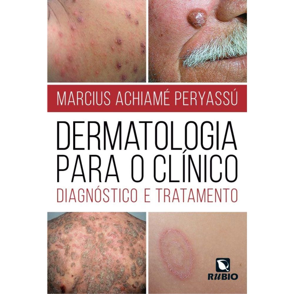 Dermatologia Para O Clinico: Diagnostico E Tratamento