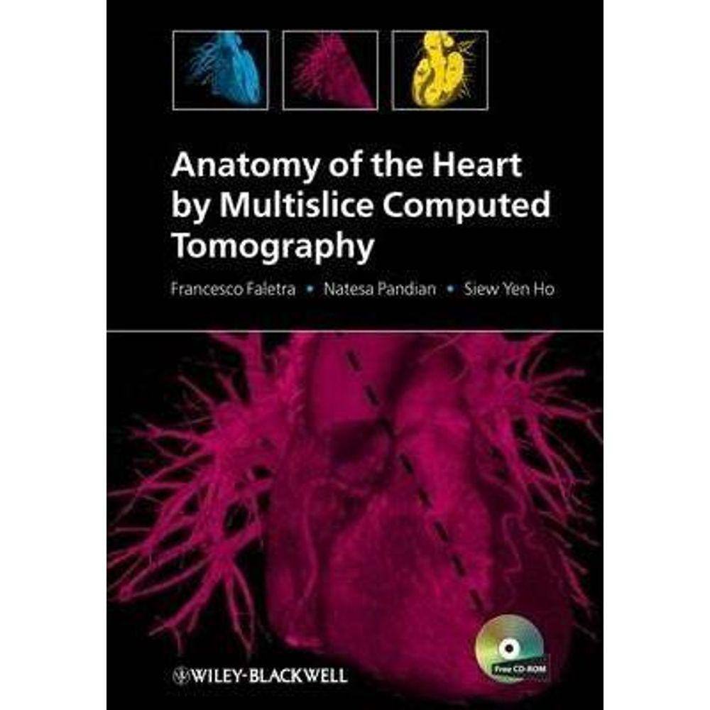 Anatomy Of The Heart By Multislice Computed Tomography