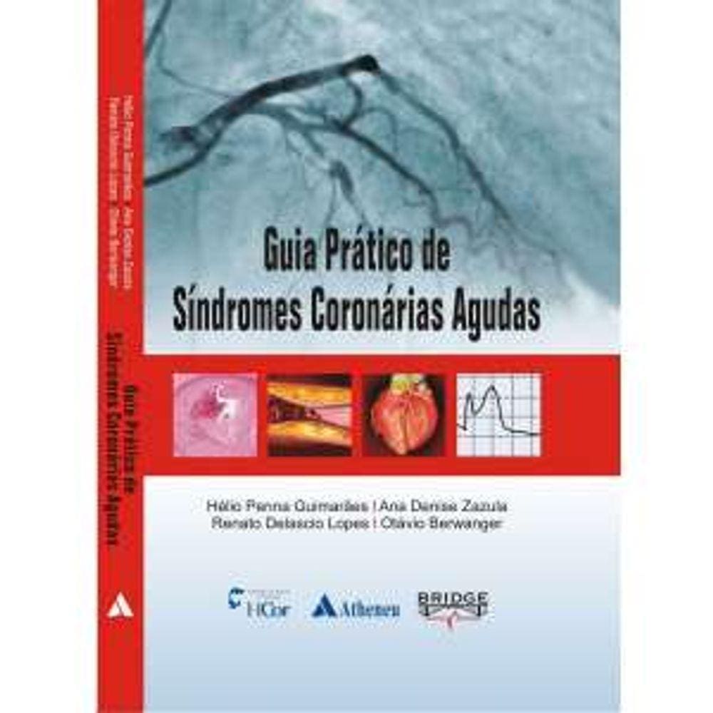 Guia Prático de Síndromes Coronárias Agudas