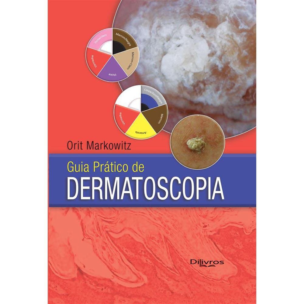 Guia Pratico De Dermatoscopia