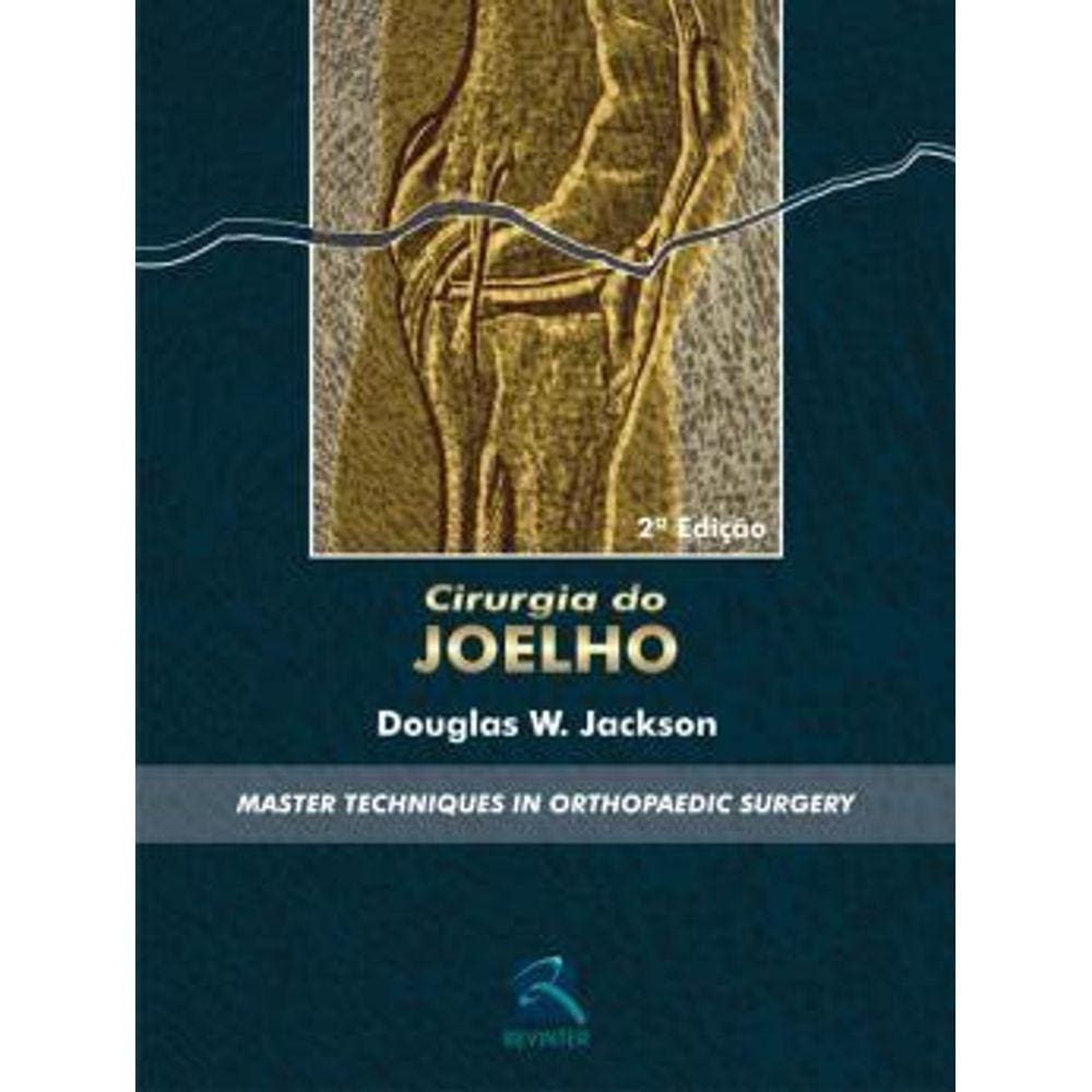 Cirurgia Do Joelho