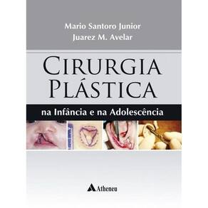 Cirurgia Plastica Na Infancia E Na Adolescencia