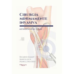 Cirurgia Minimamente Invasiva Artroscopia Do Punho