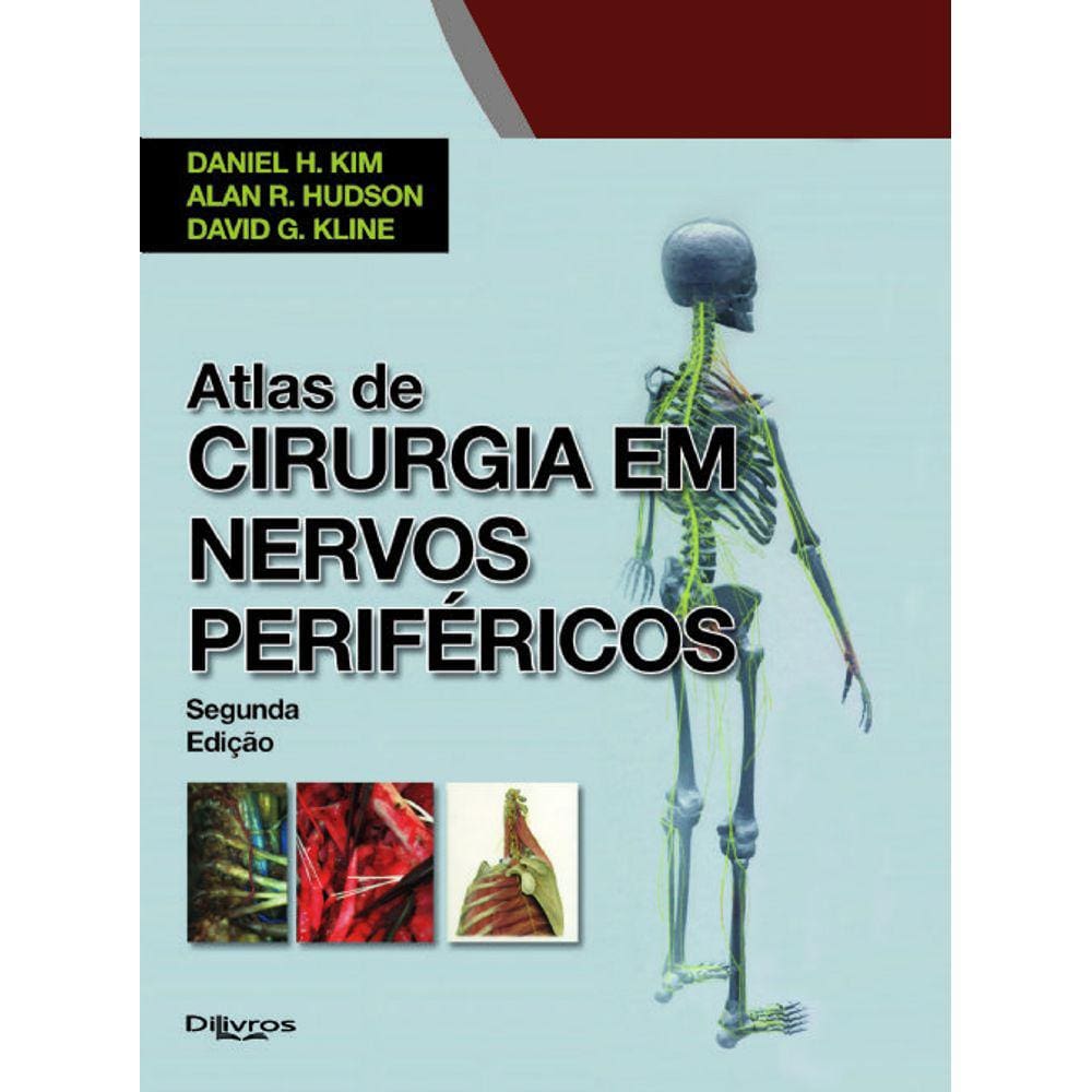 Atlas De Cirurgia Em Nervos Perifericos