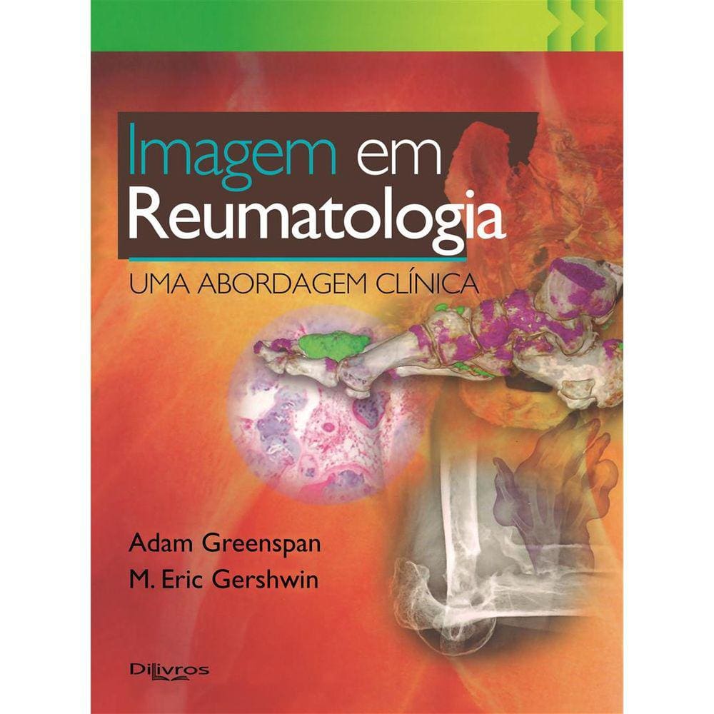 Imagem Em Reumatologia