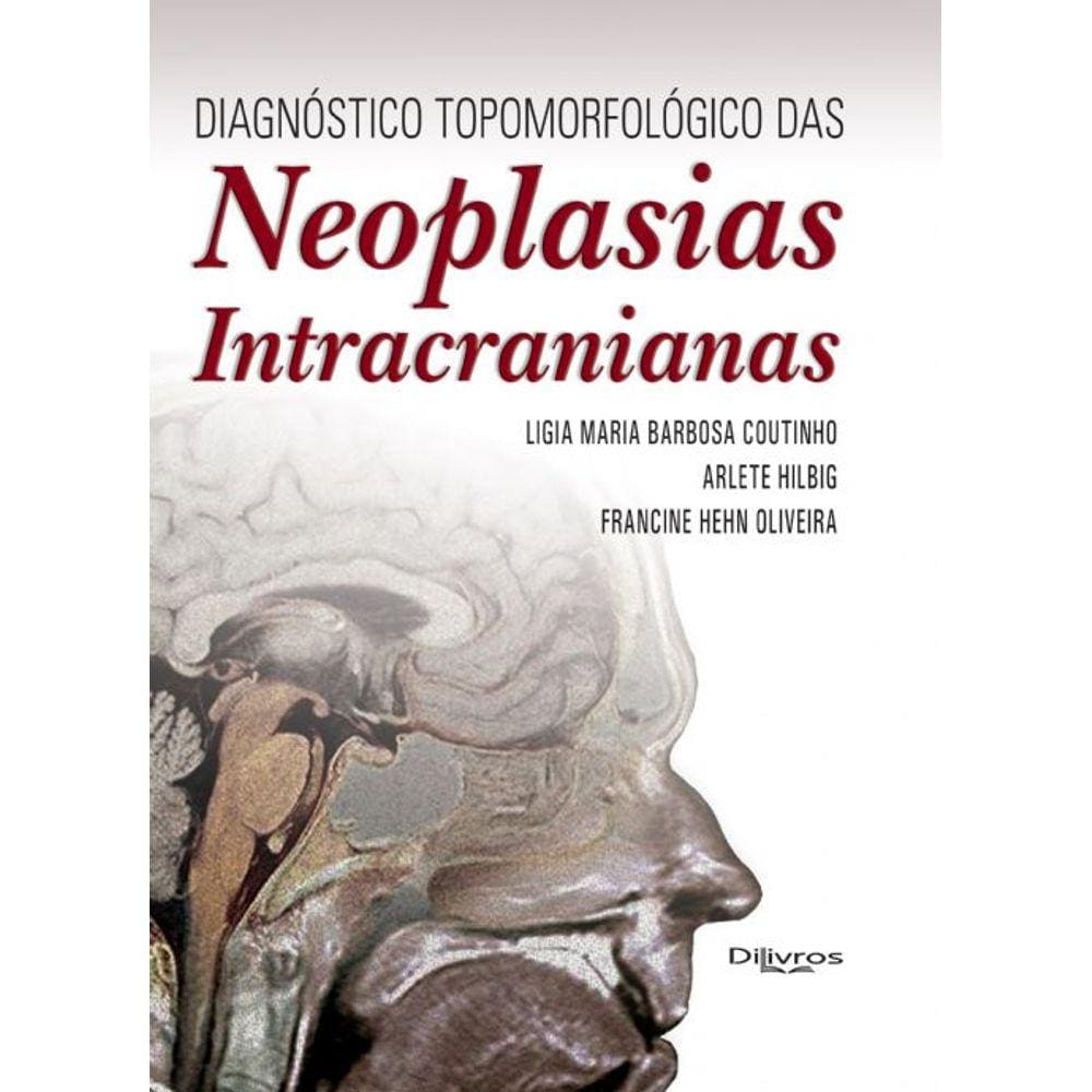 Neoplasias Intracranianas