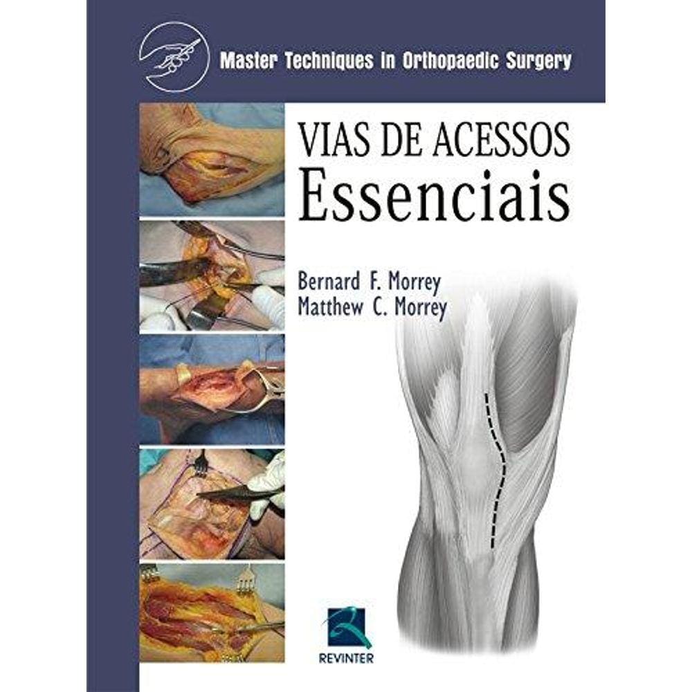 Vias De Acessos Essenciais