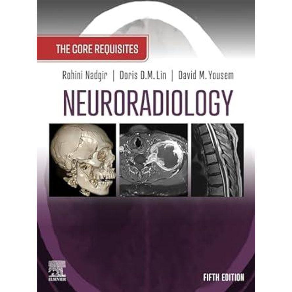 Neuroradiology
