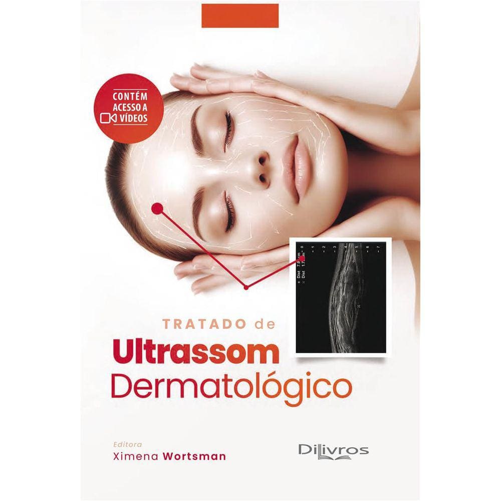 Tratado de Ultrassom Dermatológico