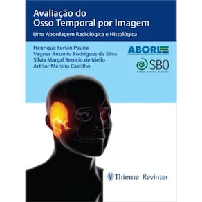 Aborl Avaliação Do Osso Temporal Por Imagem