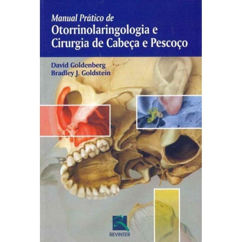 Manual Prático de Otorrinolaringologia e Cirurgia de Cabeça e Pescoço