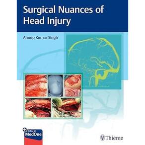 Surgical Nuances Of Head Injury