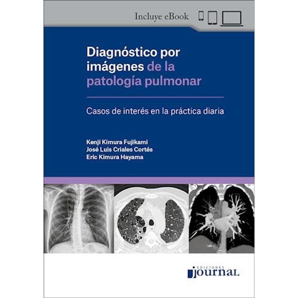 Diagnostico Por Imagenes De La Patologia Pulmonar