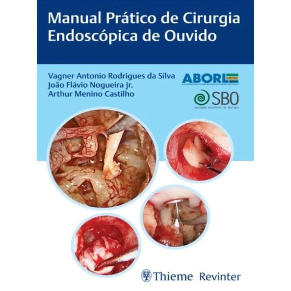 Manual Prático de Cirurgia Endoscópica de Ouvido
