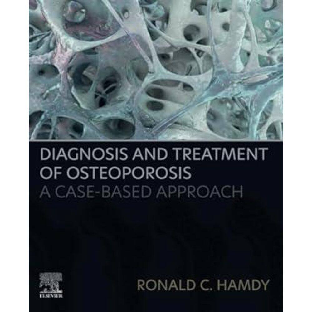 Diagnosis And Treatment Of Osteoporosis