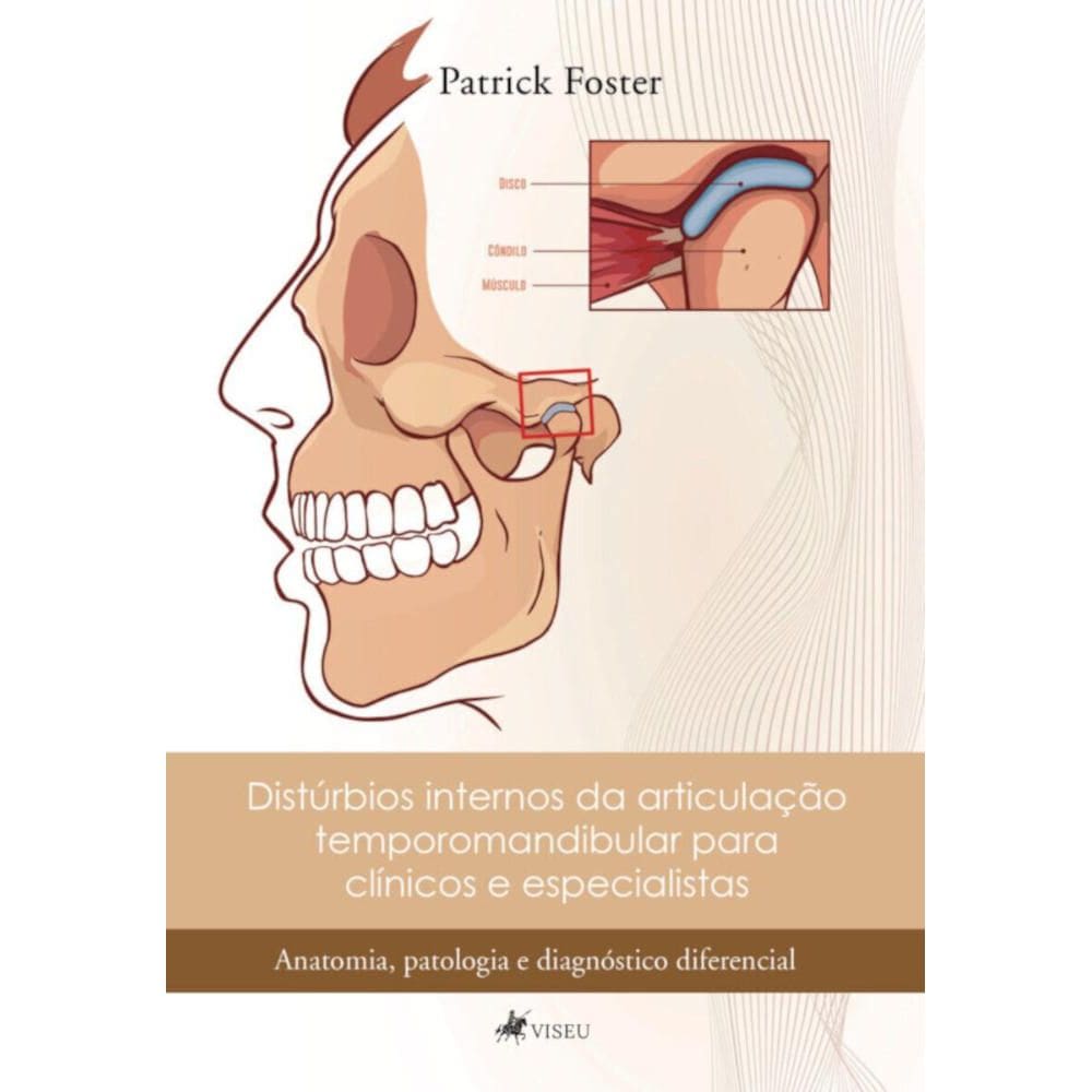 Dist?rbios internos da articula??o temporomandibular para cl?nicos e especialistas: Anatomia, patologia e diagn?stico diferencial