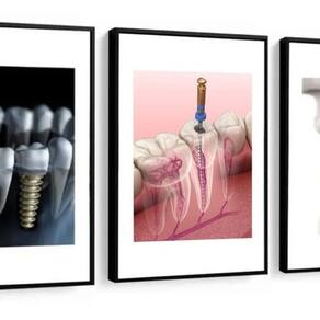 Kit 3 Quadros Decorativos Odontologia Consultório Dentistas 60x40 Vinil Colorido