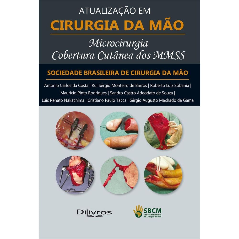 Microcirurgia Cobertura Cutanea Dos Mmss Atualizacao Em Cirurgia Da Mao