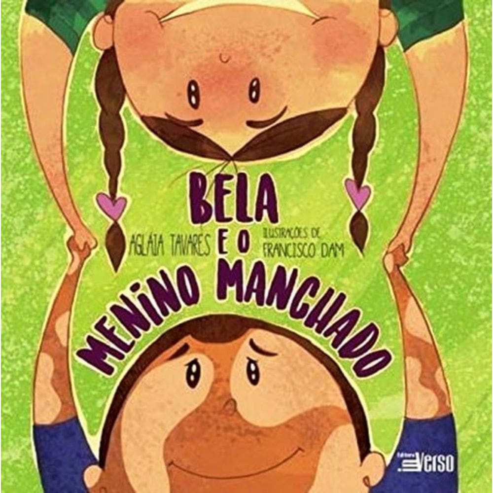 Bela E O Menino Manchado