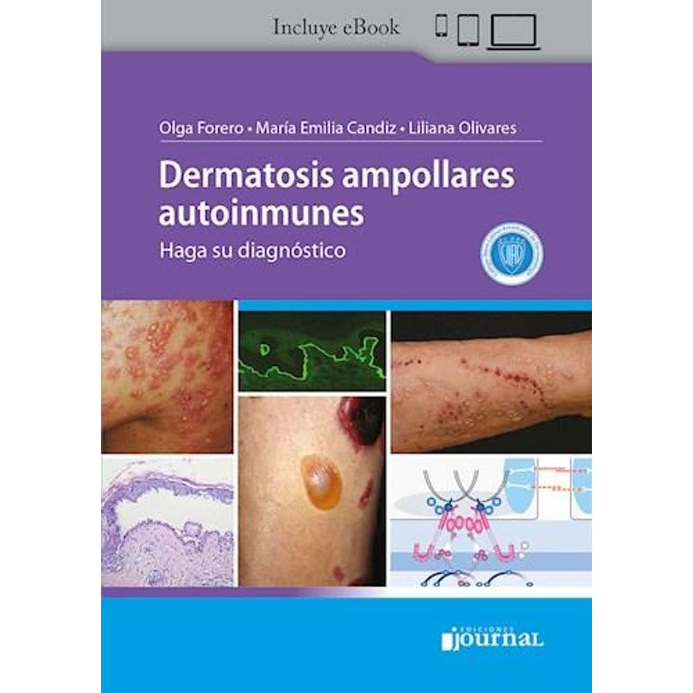 Dermatosis Ampollares Autoinmunes Haga Su Diagnostico