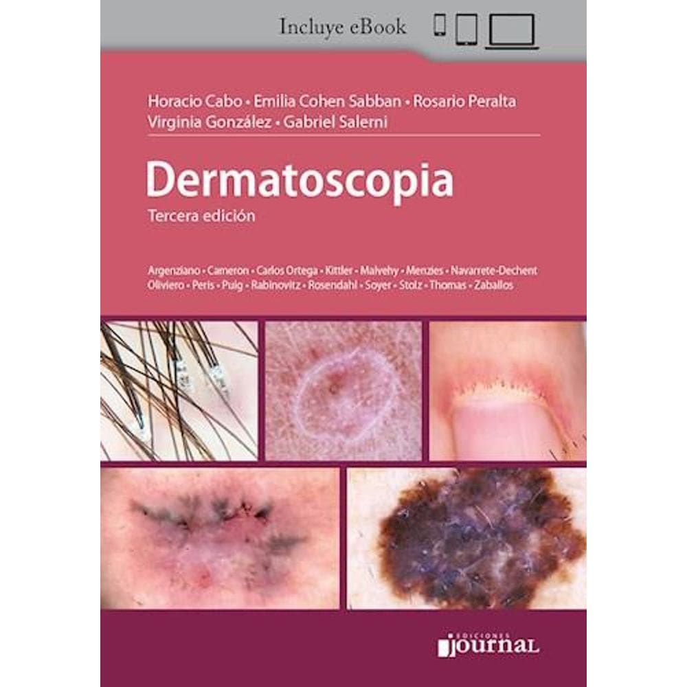 Dermatoscopia (Espanhol)